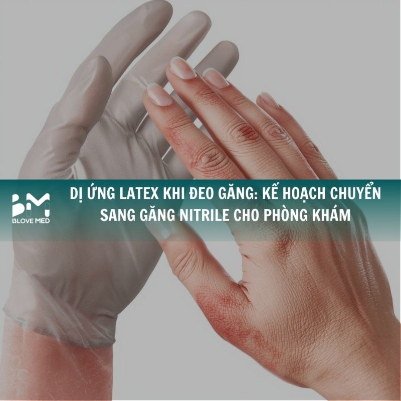 di-ung-latex-khi-deo-gang-ke-hoach-chuyen-sang-gang-nitrile-cho-phong-kham