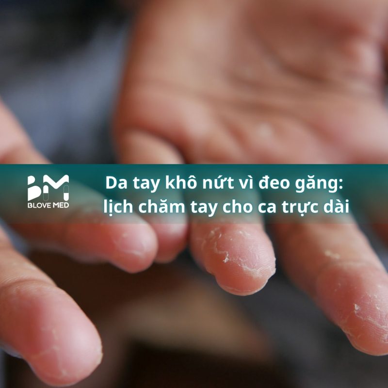 039 Da tay khô nứt vì đeo găng_ lịch chăm tay cho ca trực dài