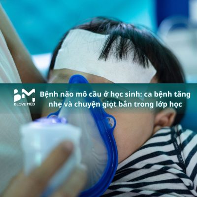 048 Bệnh não mô cầu ở học sinh_ ca bệnh tăng nhẹ và chuyện giọt bắn trong lớp học